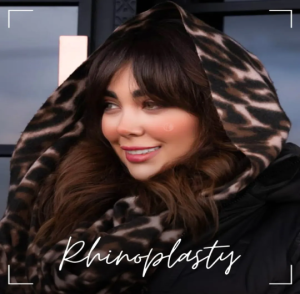 rhinoplasty-118