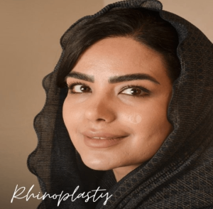rhinoplasty-123
