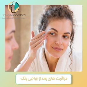 مراقبت های بعد از جراحی پلک - دکتر نادیا گودرزی