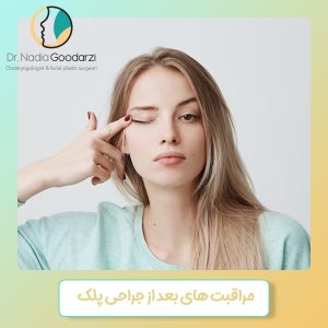 مراقبت های بعد از جراحی پلک - دکتر نادیا گودرزی