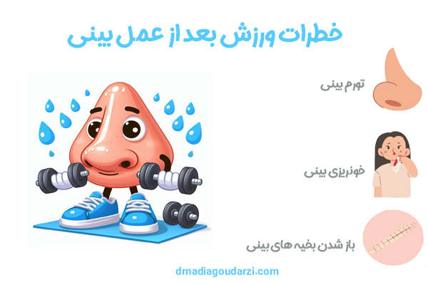 ورزش بعد از جراحی بینی - دکتر نادیا گودرزی