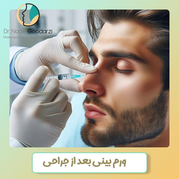 ورم بینی بعد از جراحی - دکتر نادیا گودرزی