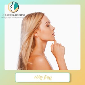 پروتز چانه - دکتر نادیا گودرزی
