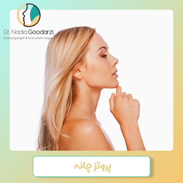پروتز چانه - دکتر نادیا گودرزی