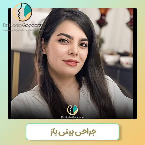 جراحی بینی باز - دکتر نادیا گودرزی