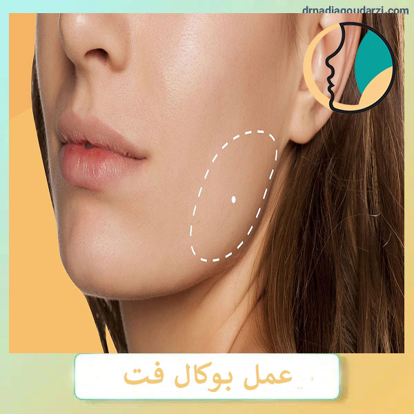 عمل بوکال فت _ دکتر نادیا گودرزی