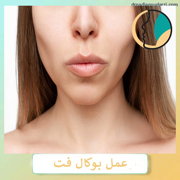 عمل بوکال فت _ دکتر نادیا گودرزی