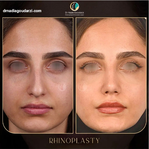 عکس عمل گوشتی و پهن