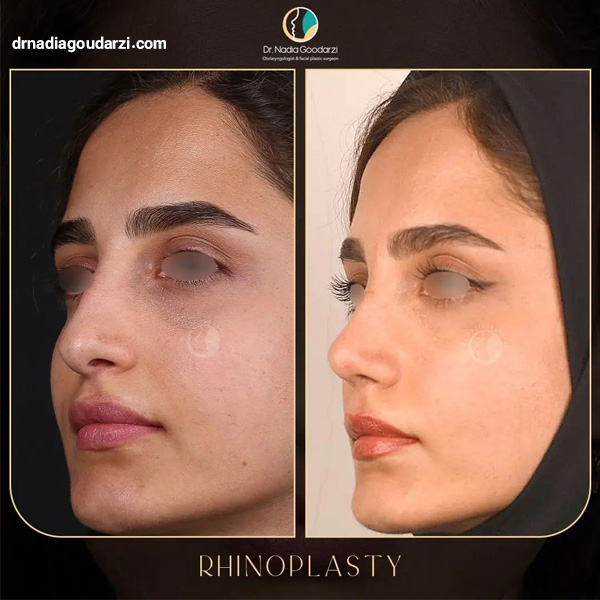 عکس عمل گوشتی و پهن