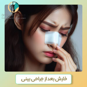 خارش بعد از جراحی بینی - دکتر نادیا گودرزی