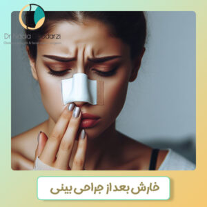 خارش بعد از جراحی بینی - دکتر نادیا گودرزی