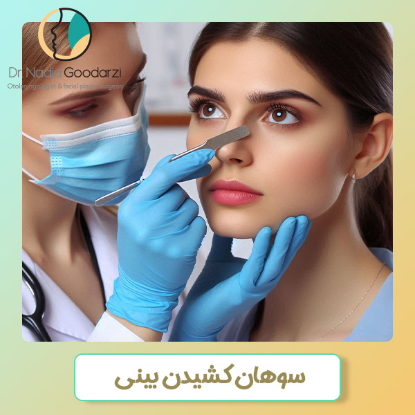 سوهان کشیدن بینی بعد از جراحی - دکتر نادیا گودرزی