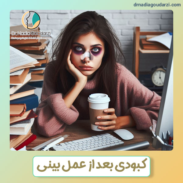 کبودی بعد از عمل بینی + دکتر نادیا گودرزی