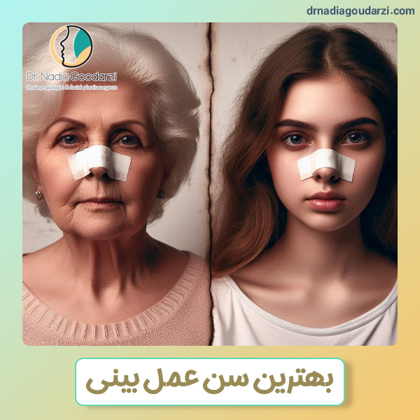بهترین سن عمل بینی + دکتر نادیا گودرزی