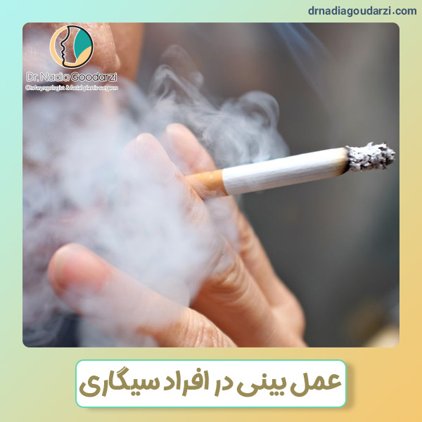 عمل بینی در افراد سیگاری + دکتر نادیا گودرزی