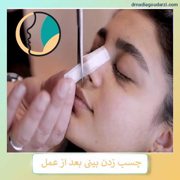 عکس چسب زدن بینی بعد از عمل _ دکتر نادیا گودرزی