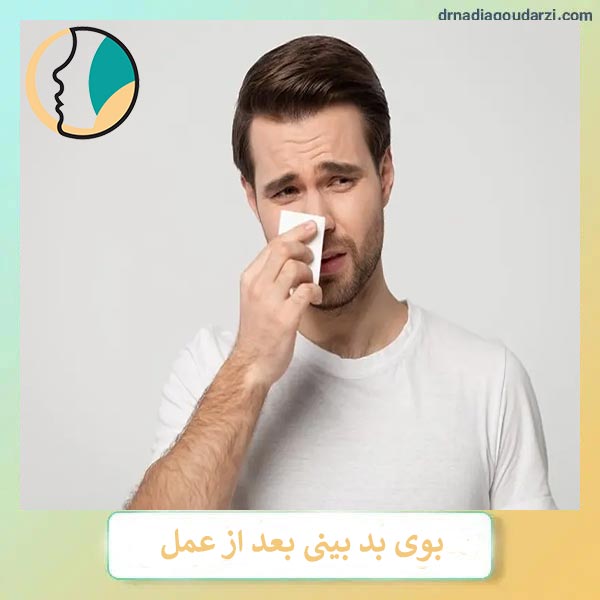 بوی بد بینی بعد از عمل _ دکتر نادیا گودرزی