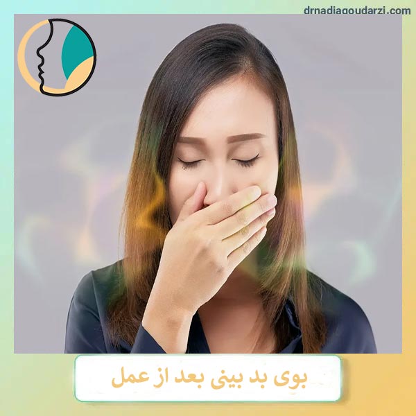 بوی بد بینی بعد از جراحی _ دکتر نادیا گودرزی