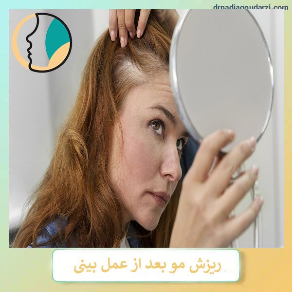 ریزش مو بعد از عمل بینی _ دکتر نادیا گودرزی
