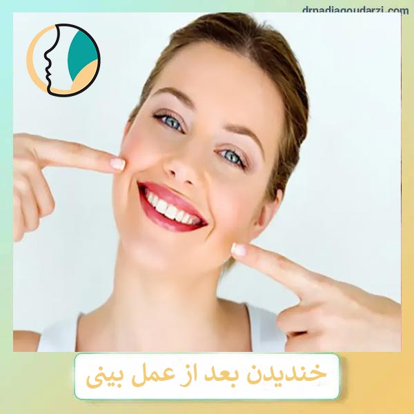 خندیدن بعد از عمل بینی _ دکتر نادیا گودرزی