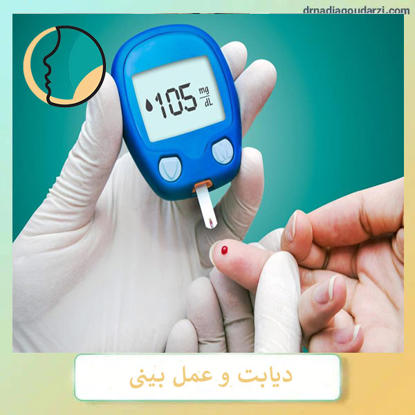 دیابت و جراحی بینی _ دکتر نادیا گودرزی