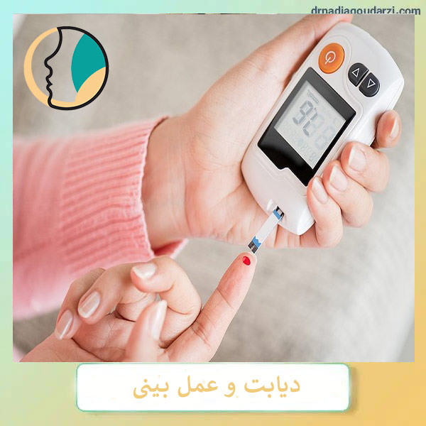 دیابت و جراحی بینی _ دکتر نادیا گودرزی