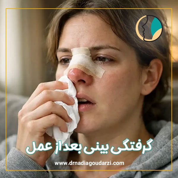 گرفتگی بینی بعد از عمل + دکتر نادیا گودرزی