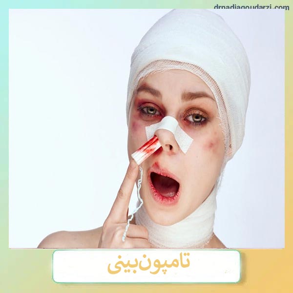 تامپون بینی _ دکتر نادیا گودرزی