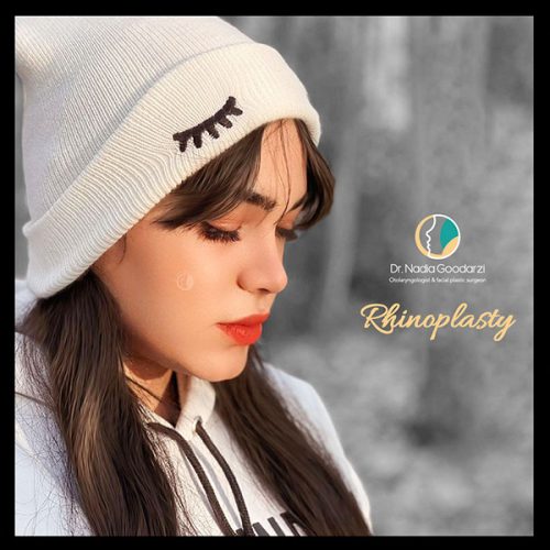جراحی-بینی-24 نمونه کار جراحی بینی - دکتر نادیا گودرزی